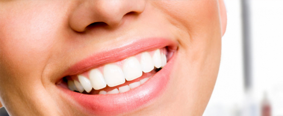 Aplicação de Botox Odontológico para Estética na Barra Funda - Botox para Diminuir o Sorriso Gengival