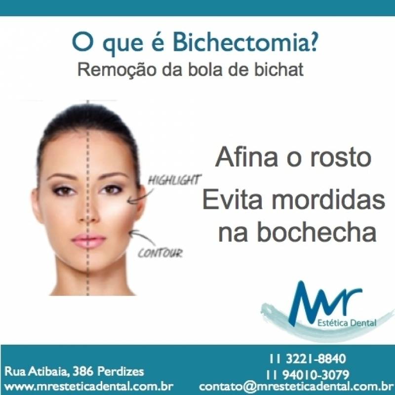 Bichectomia Dentista Preço na Vila Madalena - Bichectomia para Reduzir Bochechas