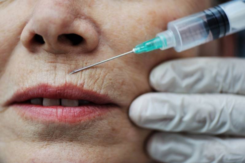 Botox Odontológico para Estética em São Domingos - Dentista Que Usa Botox