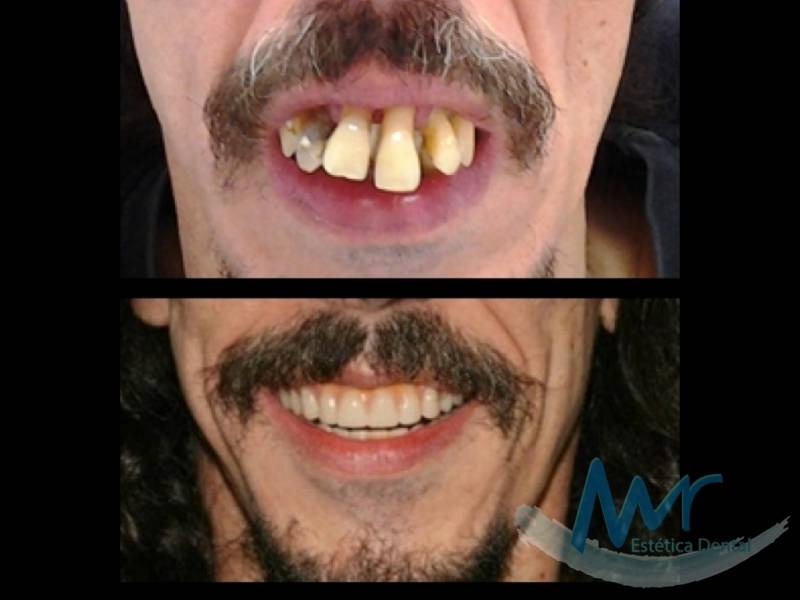 Check Up Digital Preventivo Odontológico em Perdizes - Clínica Dentária para Idosos