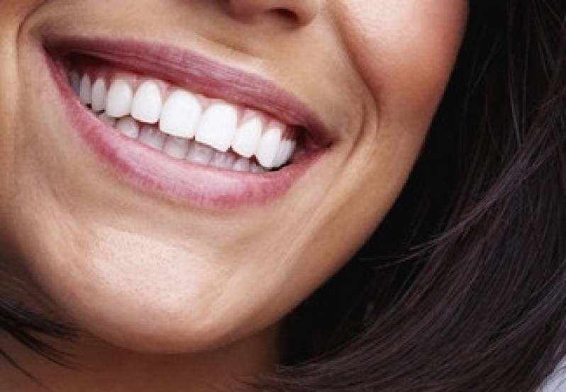 Clareamento e Branqueamento Dental Sumarezinho - Clareamento Dental