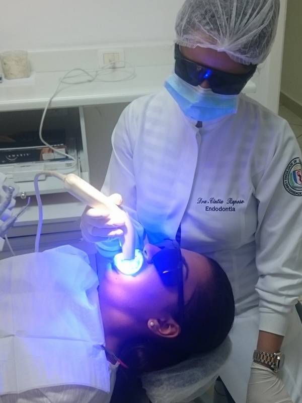 Clareamentos Dentais de Consultório Alto de Pinheiros - Clareamento Dental Interno