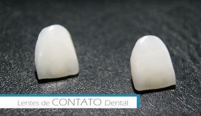 Clínica de Estética Odontológica na Pompéia - Clínica de Estética Dental