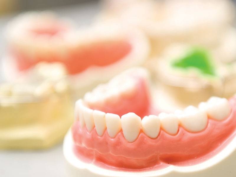 Clínica de Prótese Adesiva de Porcelana em Higienópolis - Prótese Dentária Fixa Adesiva