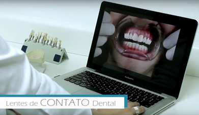 Clínicas de Estética para Dentes na Lapa - Clínica de Estética Dental para Lente Dental