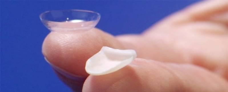 Facetas de Contato Dental Pacaembu - Faceta Dental em Porcelana