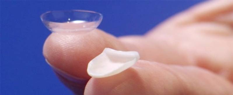 Lente de Contato Odontológica Preço Pacaembu - Lente Dentária de Porcelana