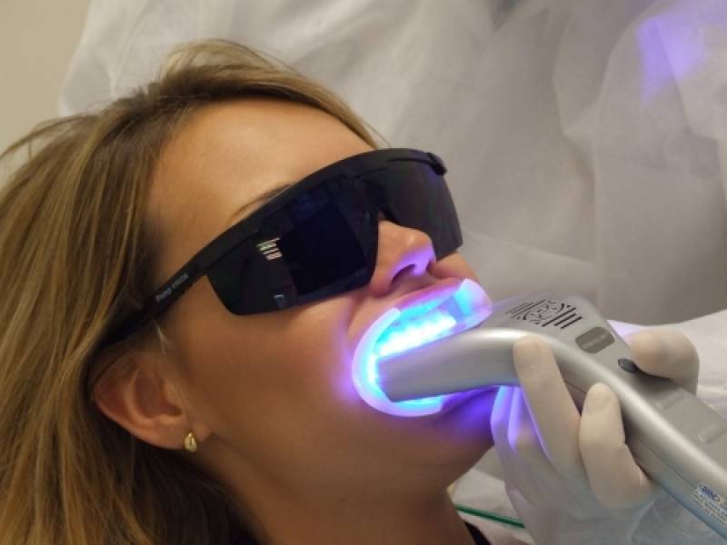 Limpezas e Clareamentos Dentais Jardim Everest - Clareamento Dental com Moldeira