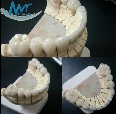 Onde Encontro Clínica para Estética Dentária na Lapa - Clínica de Estética Odontológica