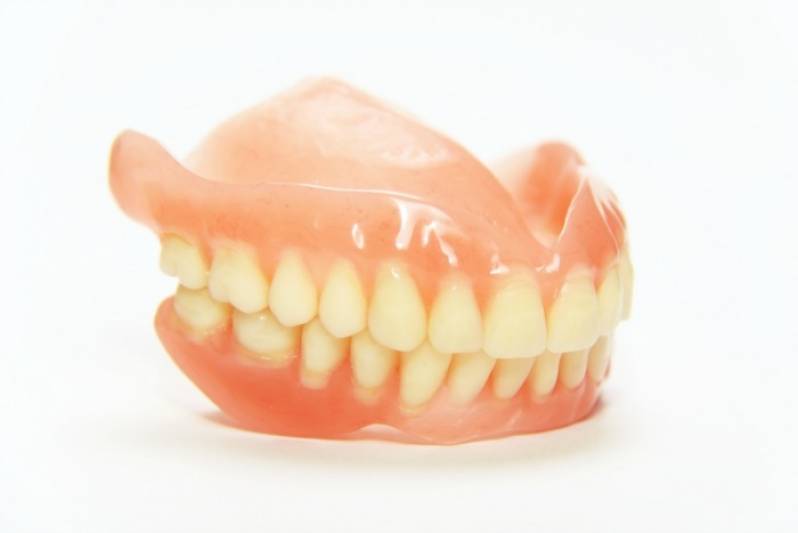Prótese Adesiva de Porcelana na Vila Madalena - Prótese Dentária Fixa Adesiva