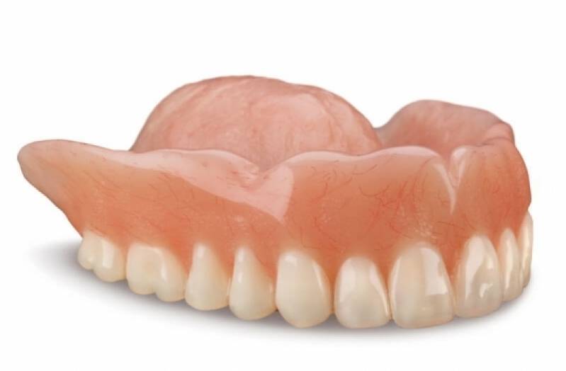 Prótese Dentária Estética Preço na Vila Leopoldina - Prótese Dentária de Porcelana