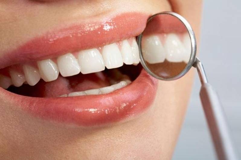 Próteses Dentárias Estética na Vila Madalena - Prótese Dentária a Grampo