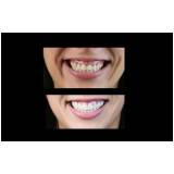 check up digitais odontológicos em Perdizes
