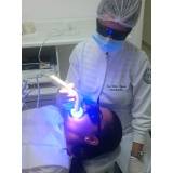 clareamento dental a laser preço na Vila Romana