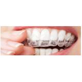 clareamento dental adesivo preço Jardim Everest