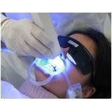 clareamento dental de dentista na Vila Romana