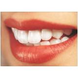 clareamento dental interno na Pompéia