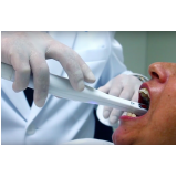 clínica de estética para implante dentário preço Parque Residencial da Lapa