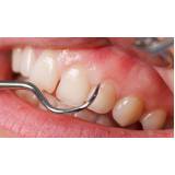 clínica de implante dentário na Água Branca