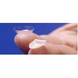 orçamento de lente de contato para os dentes em Higienópolis