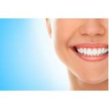 orçamento de restauração dentária com resina na Pompéia