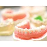 próteses dentárias removíveis Consolação