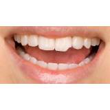 restauração dentária escura na Pompéia