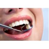 restaurações dentárias para dente quebrado na Freguesia do Ó